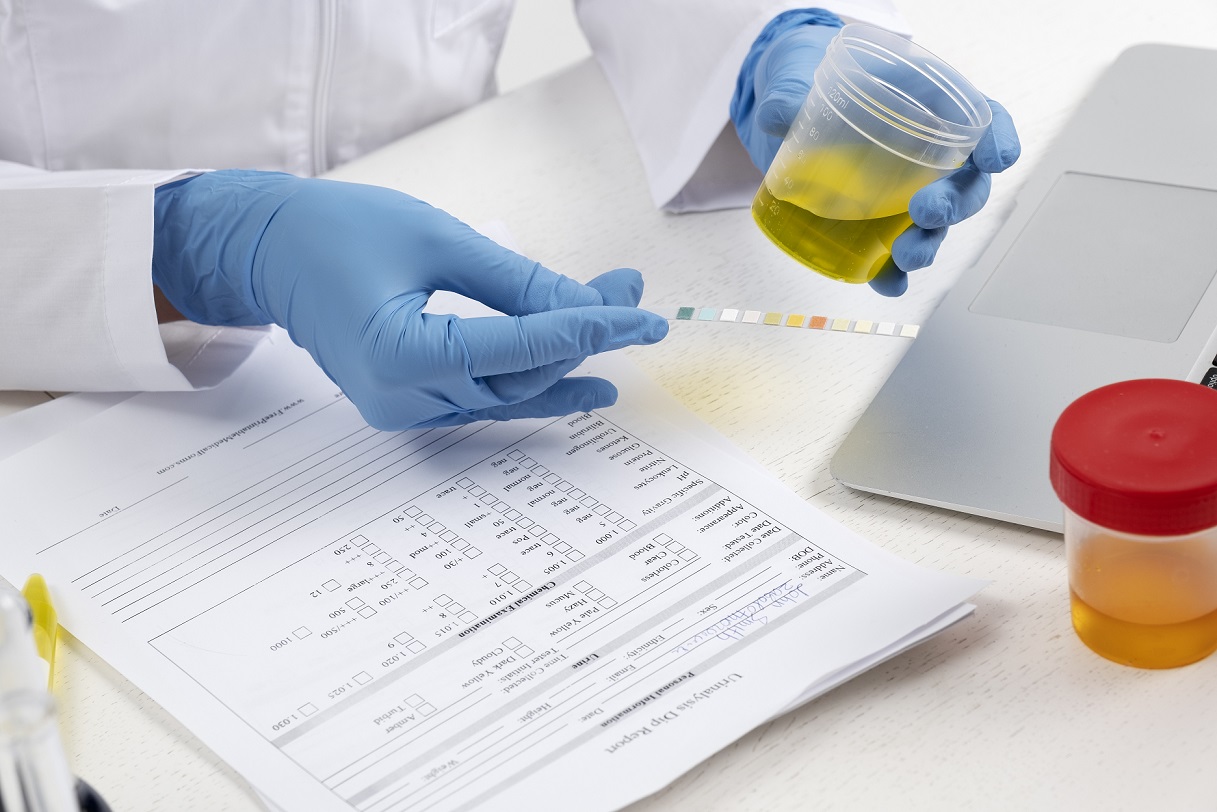 Relevance of Drug Use in Matters of Family Law